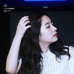 쌍수하면 <b>눈웃음</b> 사라짐?