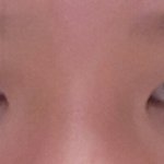 [드루와] 내일 쌍수한다 ㅆㅂ