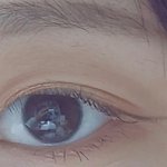 얘들아 나 눈 몽고<b>주름</b> 있는거야?