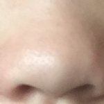 [조언부탁해] 내 돼지코(<b>복코</b>) 무슨 수술해야돼?