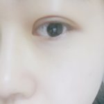 [댓글부탁해] 쌍수 라인이랑 붓기 좀 봐줄래? 살짝 멍이 있으니...