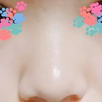 [드루와] 얘드라 내 코는 <b>복코</b>야???