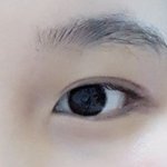 애교<b>필러</b>넣을까? (사진ㅇ)