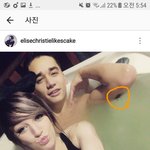 <b>윙크</b>남 팔에 이거 뭐임