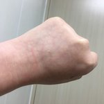 피부 이런애들 있어? ㅜㅜ