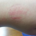 [댓글부탁해] 키스<b>마크</b> 자연스레 없어지지...?