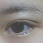 [댓글부탁해] 4일안에 붓기 거의 다 빠질까?