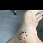 나 부주<b>상골</b>증후군 있는거야???