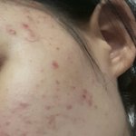 나 피부 ㄹㅇ 좋아졌지 않냐 ㅠㅜ