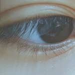 [조언부탁해] 쌍수하고 눈 더 작아<b>짐</b>;; 어떻게 해 도와줘
