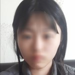 나 턱 조카 <b>비대칭</b>임