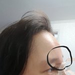 코수술하신분들중에요