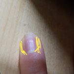 나 손톱에 검은<b>선</b>?줄?<b>이</b> 인사라져....