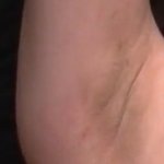 [19] 겨드랑이 나만이러냐ㅠㅠ