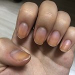 [조언부탁해] 애들아 나 <b>손톱</b> 이렇게 됨ㅠㅠ