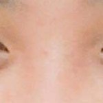 [드루와] 사진)나 <b>무쌍</b>인데 내가 쌍꺼풀만드는데 개잘만듬