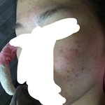 [드루와] 와 피부 개좋아짐
