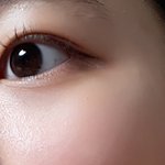 <b>좁쌀</b> 여드름 있는 애들 와봐