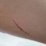 <b>아오</b> 다리 털 밀다가 베임