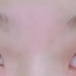 얘들아 나 앞트임 할까??