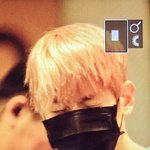 [EXO] 악 <b>변백현</b> 아프냐...