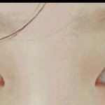 [댓글부탁해] 쌍수 <b>전이</b> 더 나음??