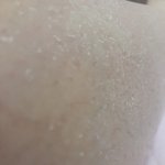 [댓글부탁해] 이거 어떻게 없애ㅠ<극극혐주의