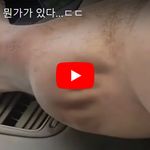 [꼭봐주세요] <b>종아리안</b>에 뭔가가 있다...ㄷㄷ