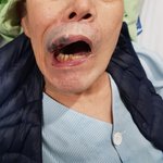 거동도 못하시는 시아버지를 간병인이 마구 때렸어요..