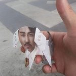 [조언부탁해] 혐)패인 흉터 좀 봐조..<b>미방</b> 있