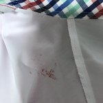 [드루와] 브레지어 끈 때문에 <b>피나</b> ㅋㅋㅋㅋㅋ