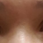 [댓글부탁해] 쌍수 망함