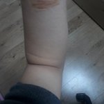 [댓글부탁해] <b>니</b>네도 여기 <b>살</b> 접히냐..?