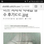 얼마 전 <b>톡선</b> 간 쌍수 후기 쓰닌데