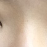 나 눈 짝짝이 <b>오짐</b>