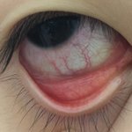 [댓글부탁해] 샤워하고눈<b>충혈</b>렌즈껴두되?ㅜ(혐주의)