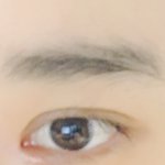 나 쌍수 망했어?ㅠㅠ