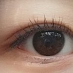 [<b>오잉</b>] 오늘 쌍수했냐는 소리들음