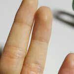 [댓글부탁해] 나 손 데었ㄹ<b>느</b>ㅡㄴ데 어떡해?ㅜㅜㅠ