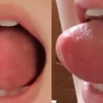 [드루와] 니네 혀 부풀리기 <b>가능</b>해???