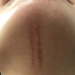 [드루와] 도대체 뭐하다 생긴 상처지