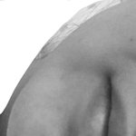 나 얼굴 비대칭이 너무 심해