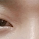 [조언부탁해] <b>짝눈</b> 해결