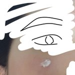 아 갑자기 <b>눈</b> <b>밑</b>쪽에 모기 물린 것처럼