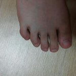 [댓글부탁해] 내새끼발<b>가락</b> 장애임 ㅠㅠ