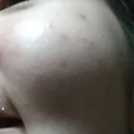 야 나 웃을때 <b>광대가</b> 너무 심한데 어캄