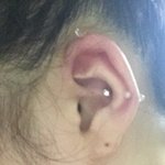나 헬<b>릭스</b> 뚫았믄데 조카 띵띵 부었어