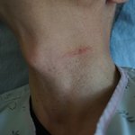 [꼭봐주세요] 아빠가 같은 버스기사한테 폭행당했습니다..