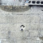 너무잔병치레가 많아서 걱정이야