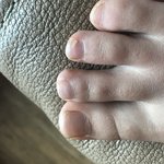 [댓글부탁해] 이거 <b>무좀</b>이야? 봐주라 ㅠ